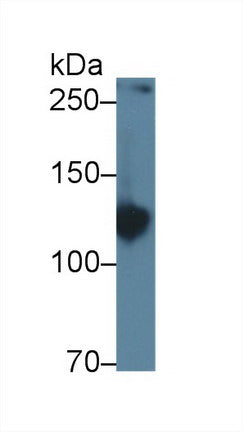 Western Blot; Sample: Recombinant protein.