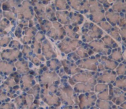 Amphiphysin (AMPH) Polyclonal Antibody - image 4
