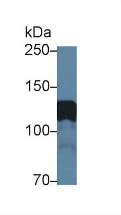 Western Blot; Sample: Recombinant protein.