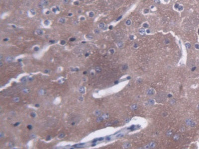 Amphiphysin (AMPH) Polyclonal Antibody - image 4