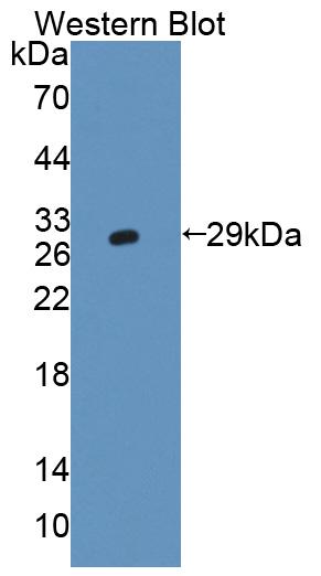DAB staining on IHC-P; Samples: Human Cerebrum Tissue;  Primary Ab: 20µg/ml Rabbit Anti-Human AMPH A