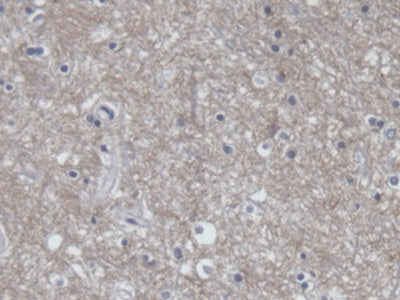 Amphiphysin (AMPH) Polyclonal Antibody - image 5