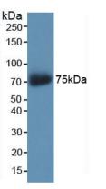 Western Blot; Sample: Human Lung lysate; Primary Ab: 2μg/ml Rabbit Anti-Human AKAP11 Antibody; Second Ab: 0.2µg/mL HRP-Linked Caprine Anti-Rabbit IgG Polyclonal Antibody;