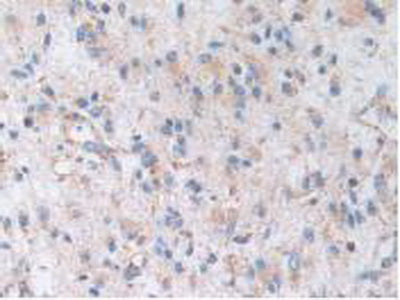 A Kinase Anchor Protein 11 (AKAP11) Polyclonal Antibody - image 5