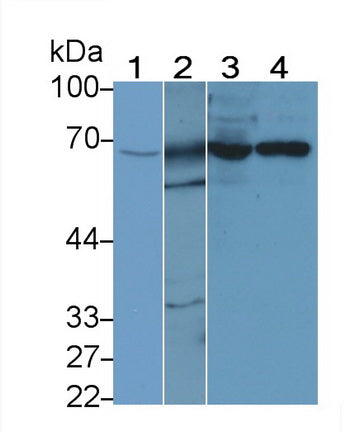 DAB staining on IHC-P; Samples: Human Prostate Tissue;  Primary Ab: 10µg/ml Rabbit Anti-Human GRK6 A