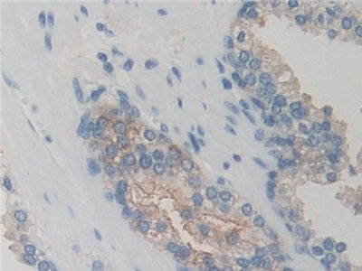 G Protein Coupled Receptor Kinase 6 (GRK6) Polyclonal Antibody - image 4