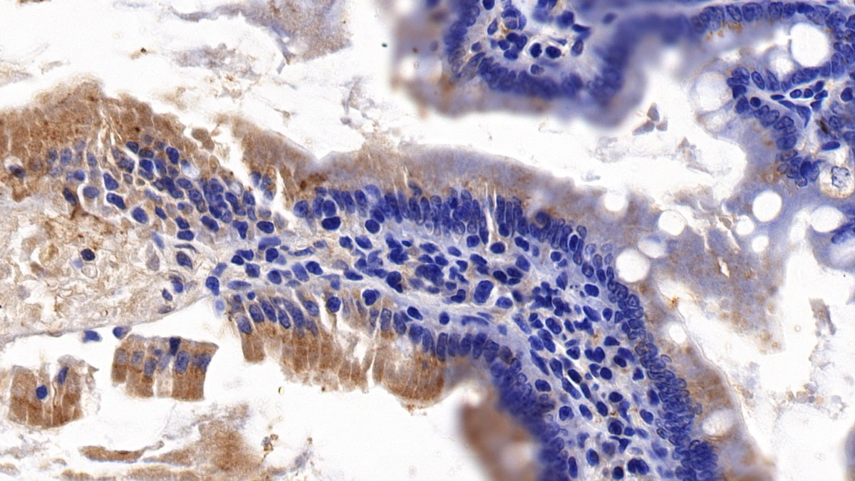 DAB staining on fromalin fixed paraffin- embedded Kidney tissue)