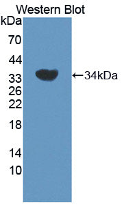 Adrenergic Receptor Beta Kinase 2 (ADRbK2) Polyclonal Antibody - image 2