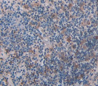 Adrenergic Receptor Beta Kinase 2 (ADRbK2) Polyclonal Antibody - image 3