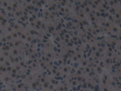 DAB staining on IHC-P; Samples: Mouse Vas Deferens Tissue.