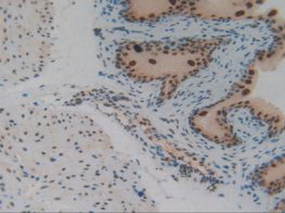 Interferon Regulatory Factor 2 (IRF2) Polyclonal Antibody - image 5