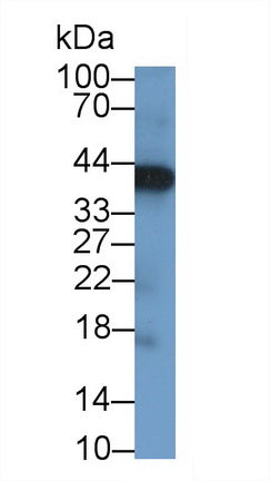 Left/Right Determination Factor 1 (LEFTY1) Polyclonal Antibody - image 3