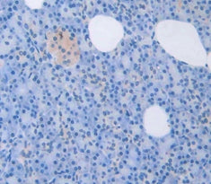 Left/Right Determination Factor 1 (LEFTY1) Polyclonal Antibody - image 4