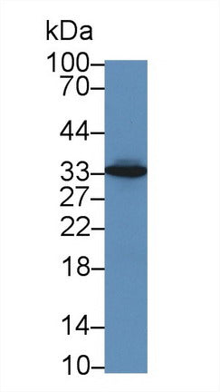 Western Blot; Sample: Recombinant protein.
