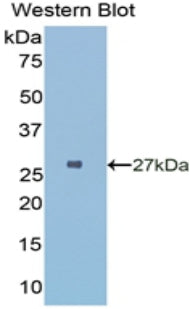 HLA Class II Histocompatibility Antigen, DR Alpha Chain (HLA-DRA) Polyclonal Antibody - image 3