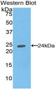 HLA Class II Histocompatibility Antigen, DR Alpha Chain (HLA-DRA) Polyclonal Antibody - image 2