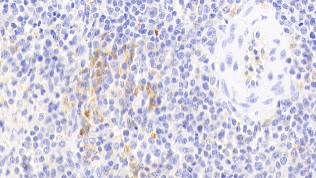 DAB staining on IHC-P; Samples: Porcine Lymph node Tissue; Primary Ab: 10μg/ml Rabbit Anti-Porcine MHCDRa Antibody Second Ab: 2µg/mL HRP-Linked Caprine Anti-Rabbit IgG Polyclonal Antibody