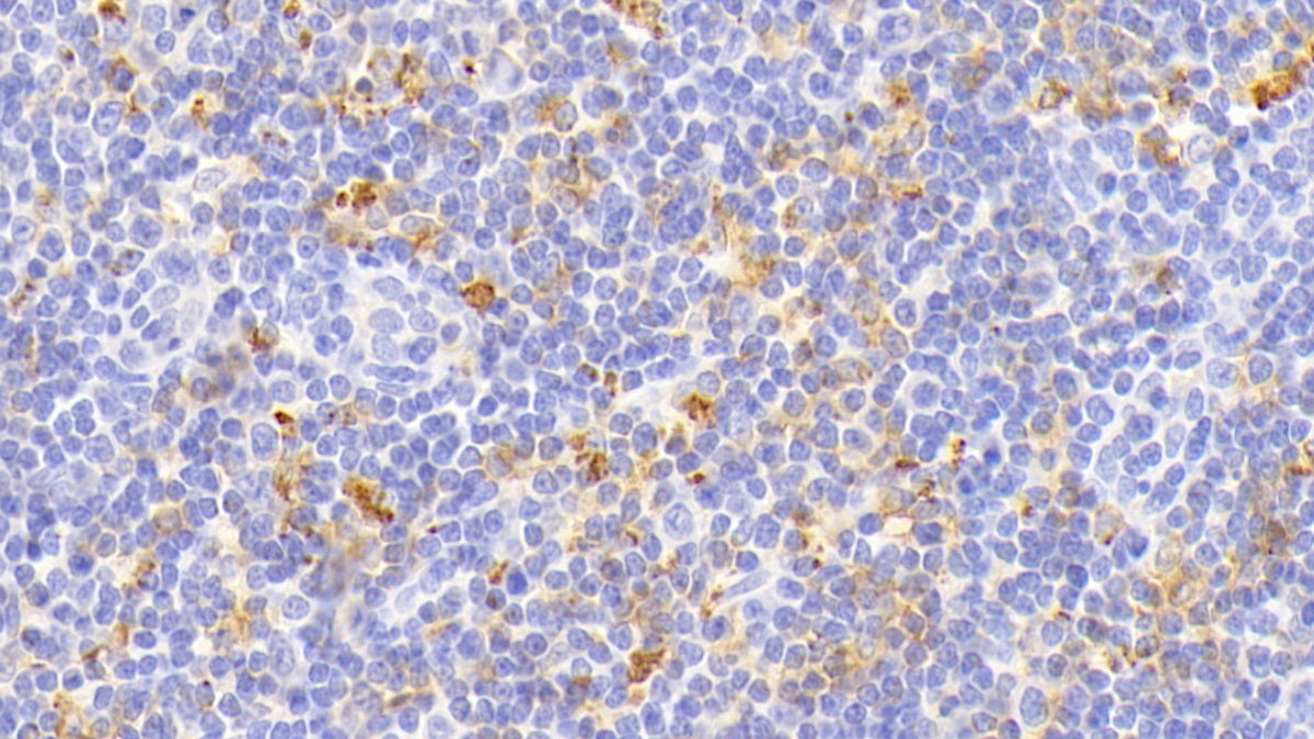 HLA Class II Histocompatibility Antigen, DR Alpha Chain (HLA-DRA) Polyclonal Antibody - image 4