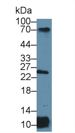 Knockout Varification: ; Lane 1: Wild-type Jurkat cell lysate; ; Lane 2: MHCDRa knockout Jurkat cell lysate; ; Predicted MW: 29kDa ; Observed MW: 25kDa; ; Primary Ab: 3µg/ml Rabbit Anti-Human MHCDRa Antibody; Second Ab: 0.2µg/mL HRP-Linked Caprine Anti-Rabbit IgG Polyclonal Antibody;
