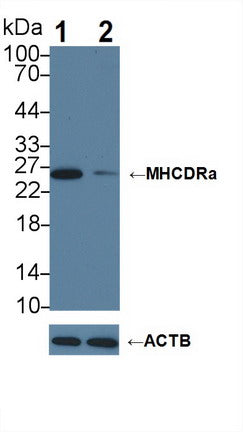 DAB staining on IHC-P; Samples: Human Kidney Tissue;  Primary Ab: 20μg/ml Rabbit Anti-Human MHCDRa Antibody Second Ab: 2µg/mL HRP-Linked Caprine Anti-Rabbit IgG Polyclonal Antibody