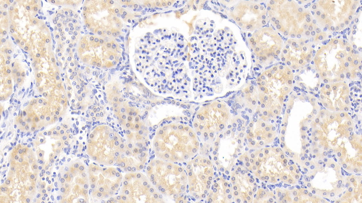 HLA Class II Histocompatibility Antigen, DR Alpha Chain (HLA-DRA) Polyclonal Antibody - image 4