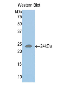 HLA Class II Histocompatibility Antigen, DR Alpha Chain (HLA-DRA) Polyclonal Antibody - image 2