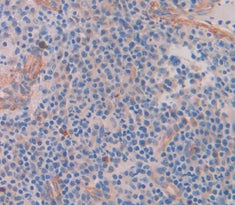 Collagen Type VII (COL7) Polyclonal Antibody - image 3