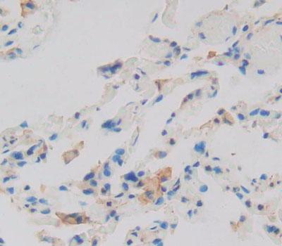 Latent Transforming Growth Factor Beta Binding Protein 1 (LTBP1) Polyclonal Antibody - image 3