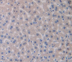 SMAD family member 3 (SMAD3) Polyclonal Antibody - image 3