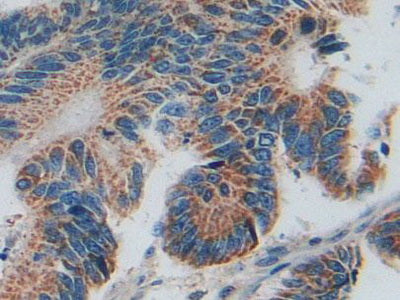 SMAD family member 5 (SMAD5) Polyclonal Antibody - image 5