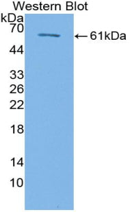 Transforming Growth Factor Beta Receptor III (TGFbR3) Polyclonal Antibody - image 2