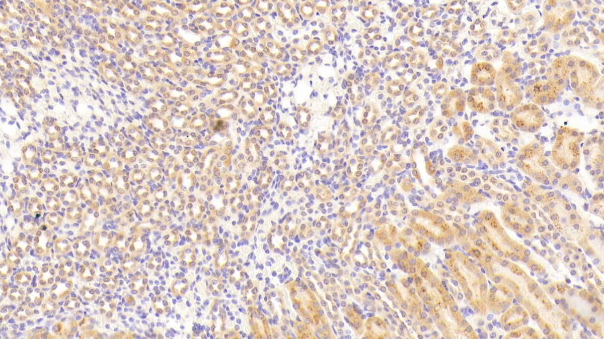 DAB staining on fromalin fixed paraffin-embedded Brain tissue)