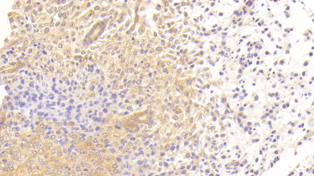 Transforming Growth Factor Beta Receptor III (TGFbR3) Polyclonal Antibody - image 4