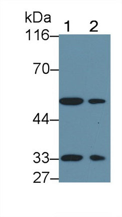 Activin A Receptor Type II B (ACVR2B) Polyclonal Antibody - image 2