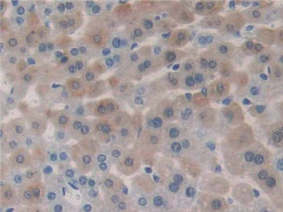 DAB staining on fromalin fixed paraffin- embedded liver tissue)