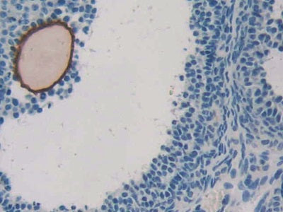 Activin A Receptor Type II B (ACVR2B) Polyclonal Antibody - image 4