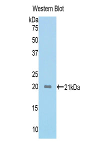 Activin A Receptor Type II A (ACVR2A) Polyclonal Antibody - image 2