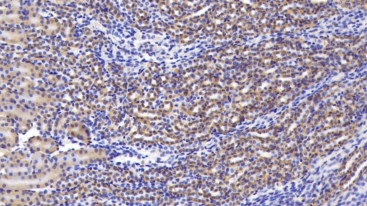 Activin A Receptor Type II A (ACVR2A) Polyclonal Antibody - image 4