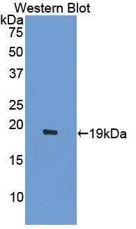 Activin A Receptor Type II A (ACVR2A) Polyclonal Antibody - image 2