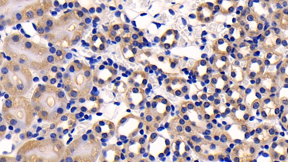 Activin A Receptor Type II A (ACVR2A) Polyclonal Antibody - image 4