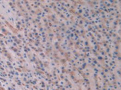 Activin A Receptor Type II A (ACVR2A) Polyclonal Antibody - image 5