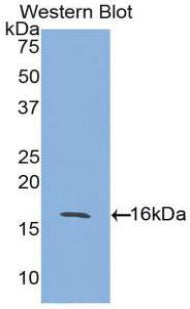 Activin A Receptor Type II A (ACVR2A) Polyclonal Antibody - image 2