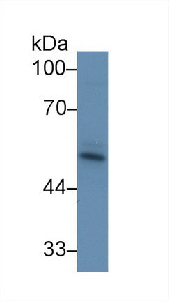 Western Blot; Sample: Recombinant protein.