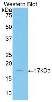 Activin A Receptor Type II A (ACVR2A) Polyclonal Antibody - image 3