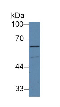 Western Blot; Sample: Recombinant protein.