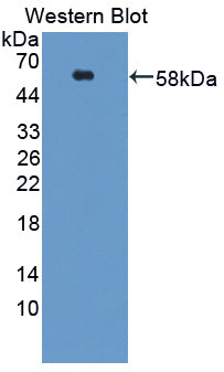 DAB staining on IHC-P; Samples: Human Cerebrum Tissue; Primary Ab: 30µg/ml Rabbit Anti-Human ACVR1C Antibody Second Ab: 2µg/mL HRP-Linked Caprine Anti-Rabbit IgG Polyclonal Antibody