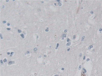 DAB staining on fromalin fixed paraffin- embedded Kidney tissue)