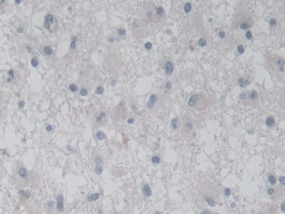Activin A Receptor Type I C (ACVR1C) Polyclonal Antibody - image 5