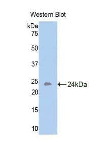 Activin A Receptor Type I B (ACVR1B) Polyclonal Antibody - image 2