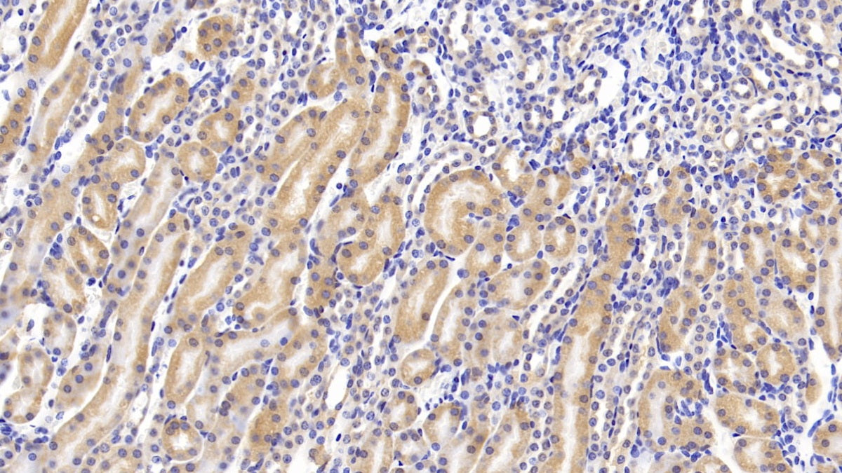 Activin A Receptor Type I B (ACVR1B) Polyclonal Antibody - image 4
